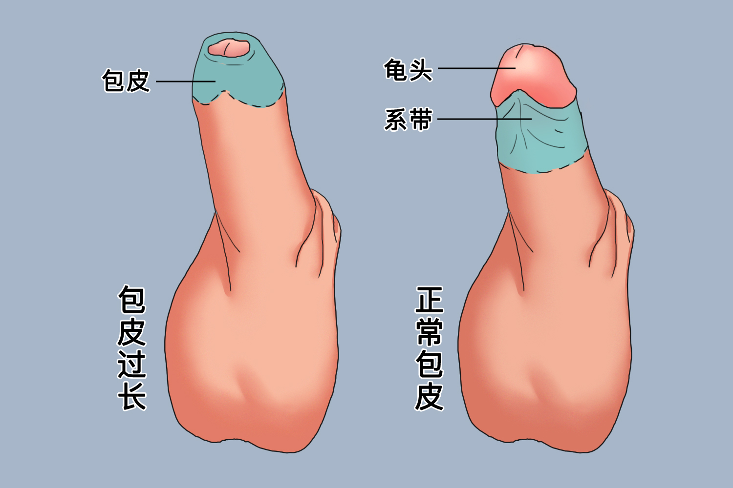 正常包皮的圖片及其相關(guān)知識(shí)科普，包皮圖片及其相關(guān)知識(shí)科普介紹