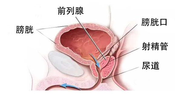 普樂安片治療前列腺炎的療程與效果，深度解析，普樂安片治療前列腺炎療程與效果深度解析，療程長短與治療效果一覽無余。