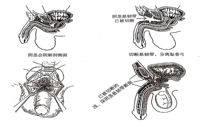 男性增大手術(shù)靠譜嗎？深度解析與探討，男性增大手術(shù)深度解析，可靠性與風(fēng)險探討